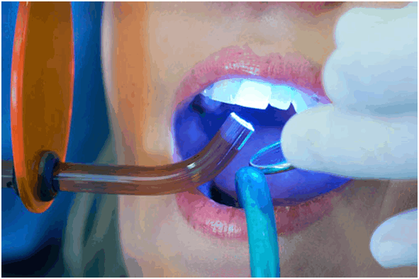 Ультрафиолетовые обогревательные устройства